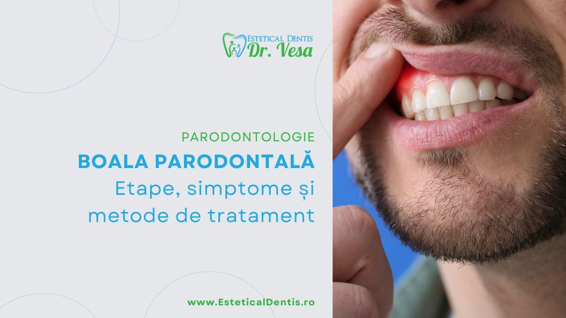 Boala parodontală etape, simptome și metode de tratament