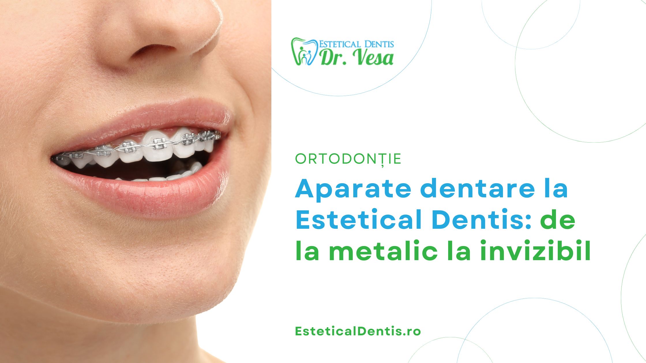 Aparate dentare la Estetical Dentis de la metalic la invizibil