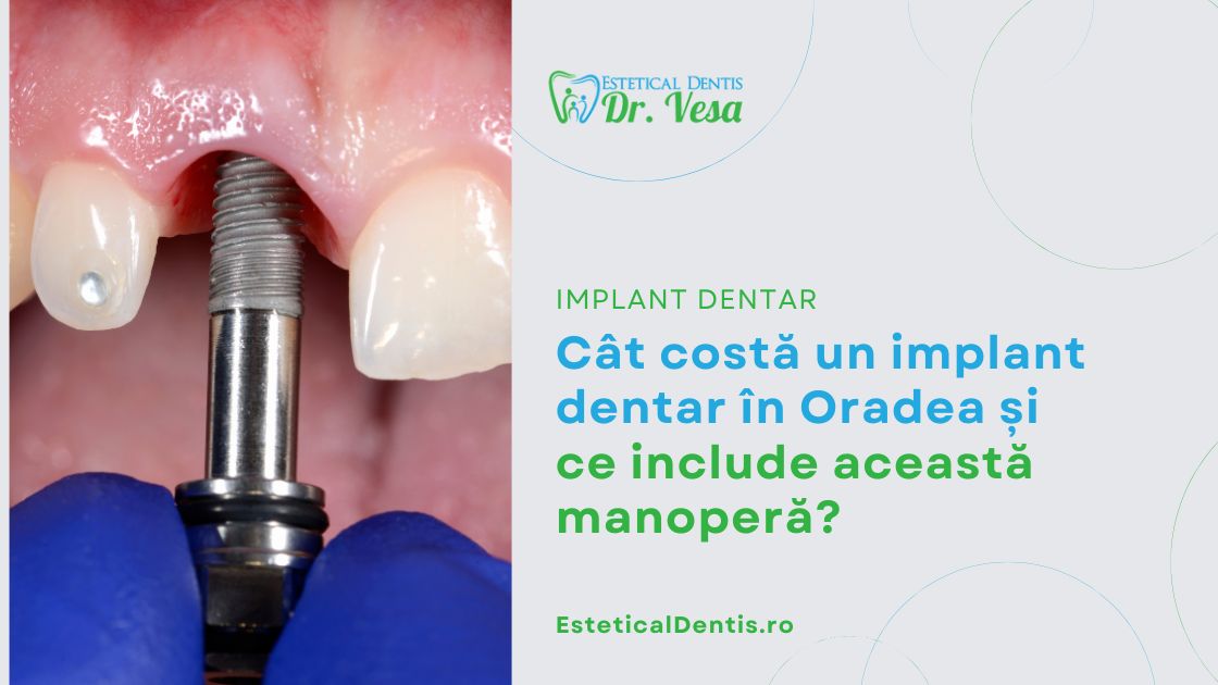 Cât costă un implant dentar în Oradea și ce include această manoperă