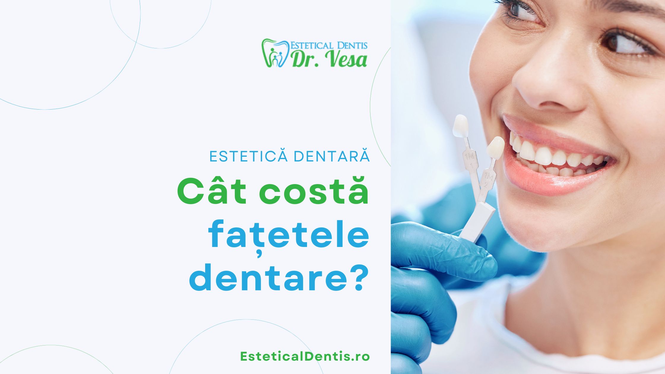 Cât costă fațetele dentare